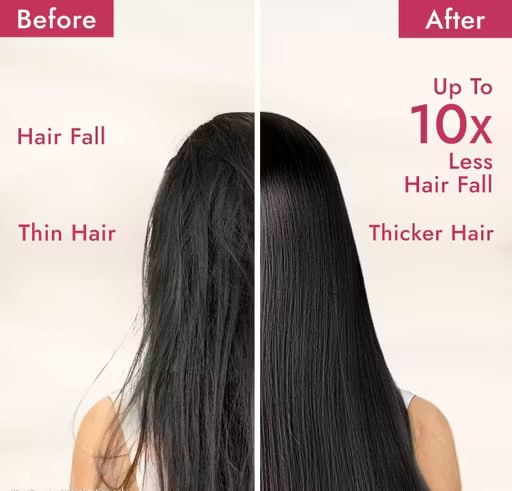 Parachute Advansed Bhringraj & Hibiscus Enriched Coconut Hair Oil – Hair Fall Control & Strong Healthy Hair | 300ml